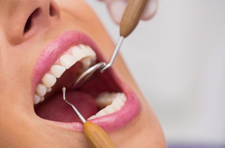 What Dental Services Are Covered Under General Dentistry?